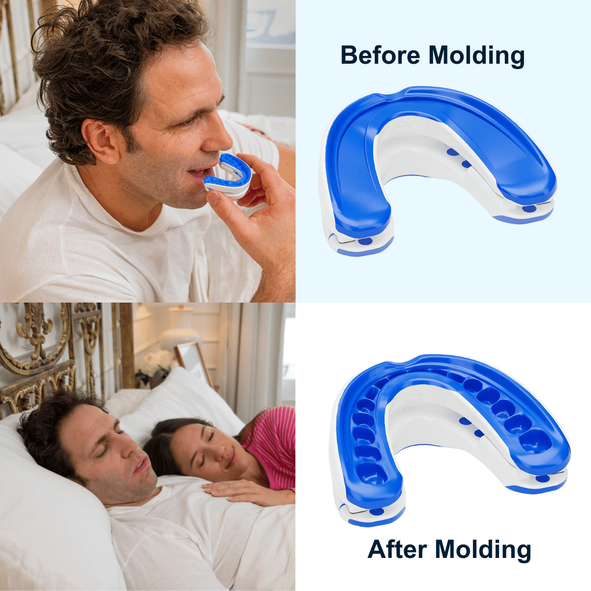 custom mandibular advancement device